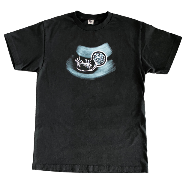 Ultrasound Tee